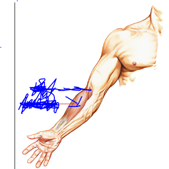 <p>Origin - <span>humerus</span></p><p>Insertion - Styloid process of radius </p><p>Action - Flexion at the elbow </p>