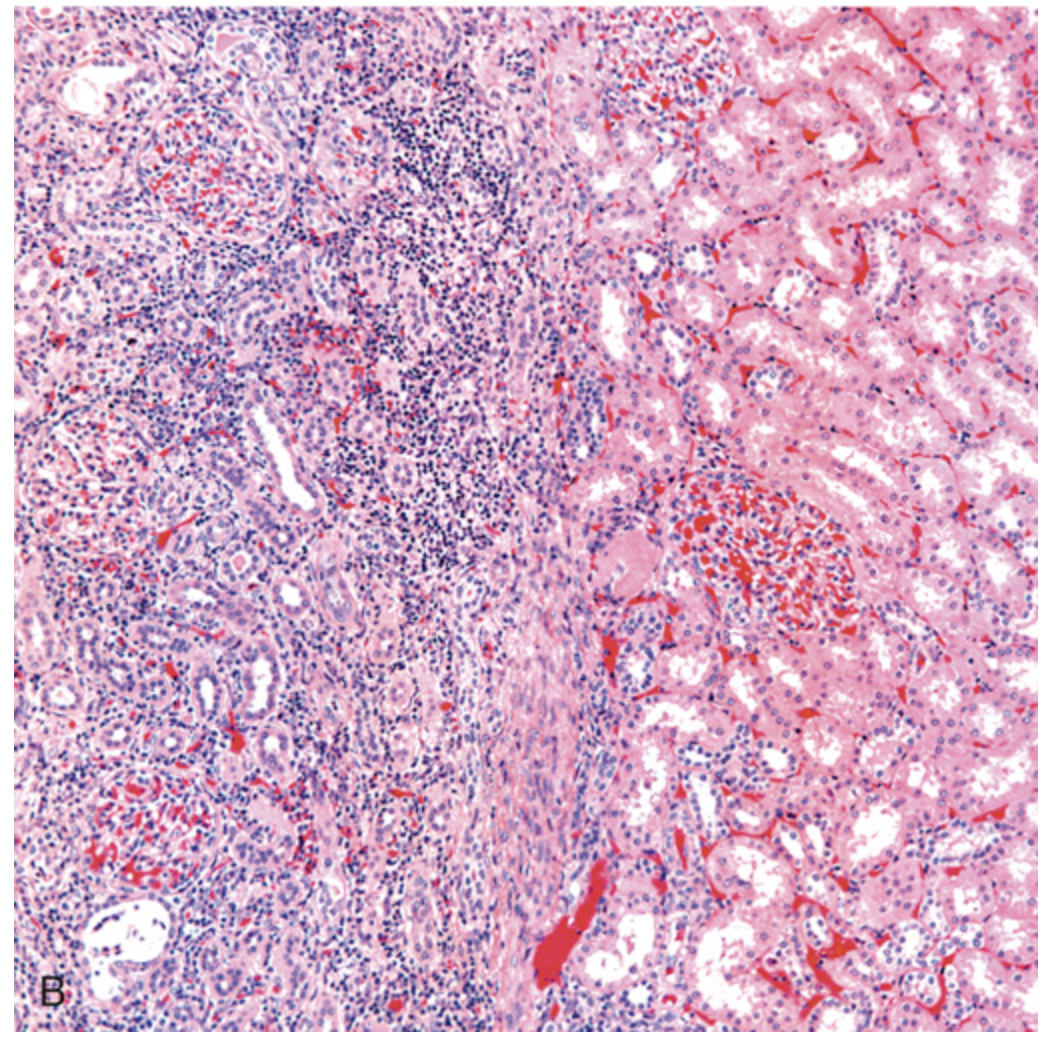 term image