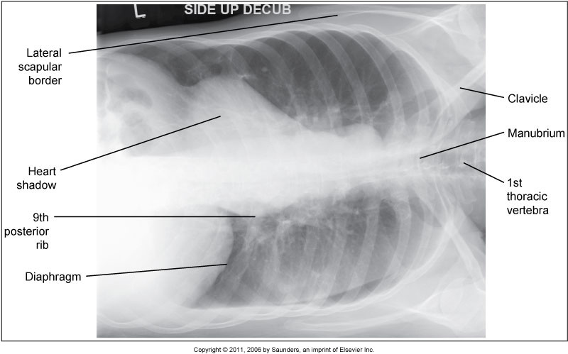 <p>What position is demonstrated?</p>