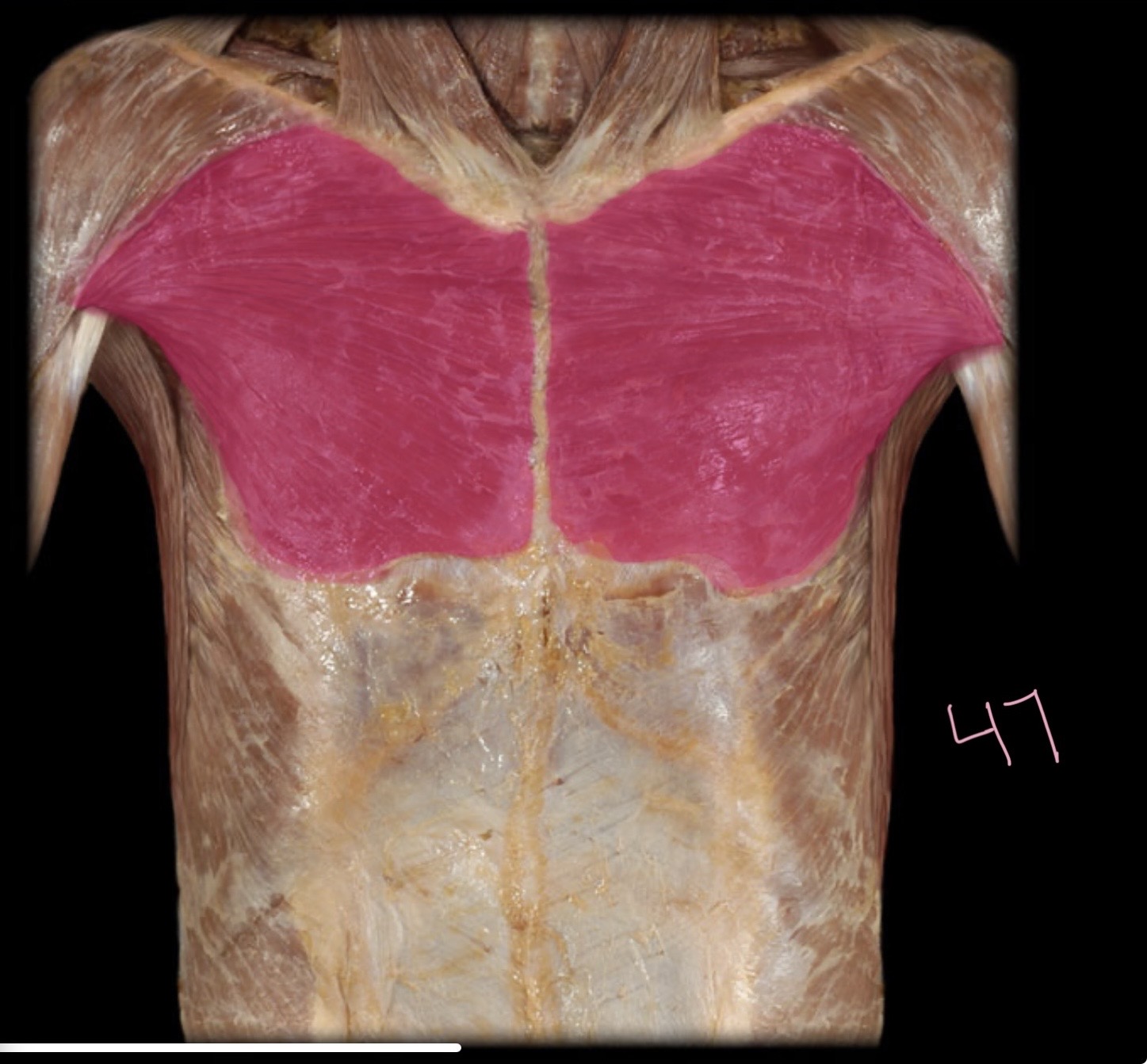 <p>Pectoralis major</p>