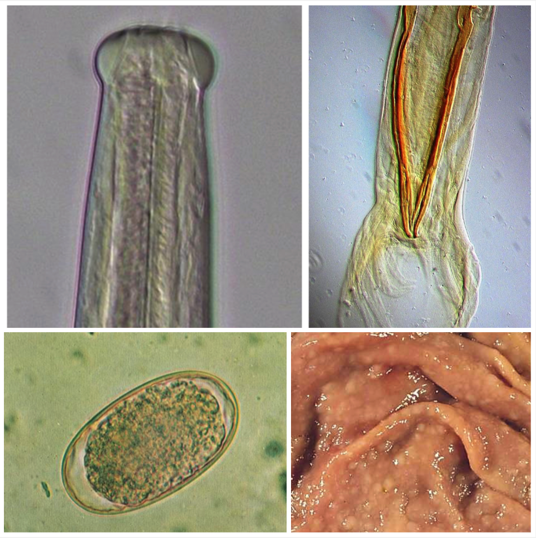 <p>ABOMASUM In April-May (Autumn) you find 18-month old beef cattle with nodules/coalesced nodules in the abomasum, anorexia, diarrhoea and weight loss. Very few eggs are found in a FEC.</p><ul><li><p>Ingestion of L3 with pasture</p></li><li><p>Hypobiotic larvae, infected in earlier warmer months and reactivated</p></li><li><p>Hyperplasia of mucous cells form nodules</p></li><li><p>Use pepsinogen and gastrin levels to diagnose due to reduction in gastric acid and alkaline stomach pH meaning no pepsin being converted from pepsinogen</p></li><li><p>Confirm diagnosis with larvae culture</p></li></ul>