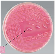 <p><strong>Lactose-fermenter bacteria</strong>, what type of media is it being cultivated on?</p>
