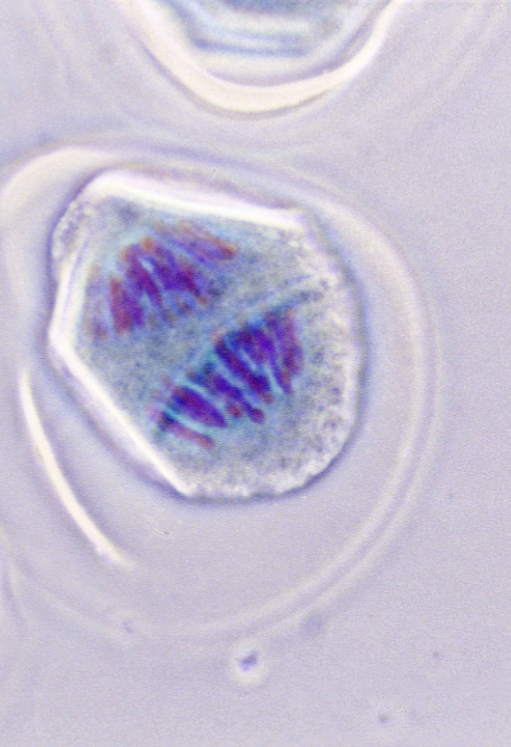 <p>what stage of cell division is this?&nbsp;</p>