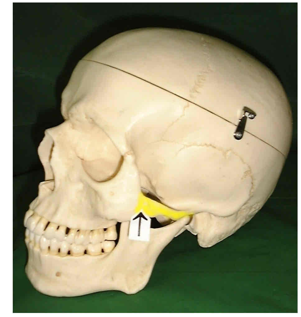 term image