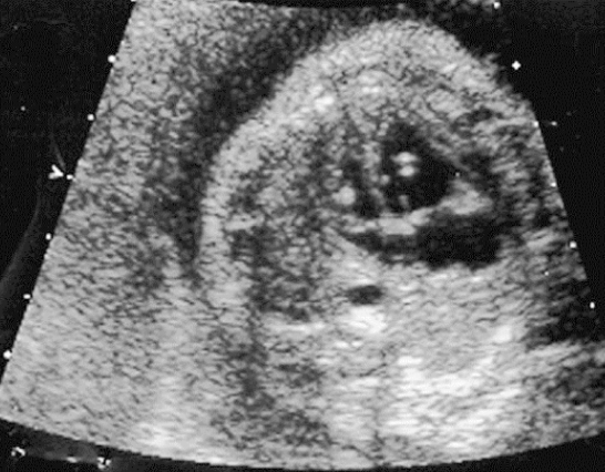 term image
