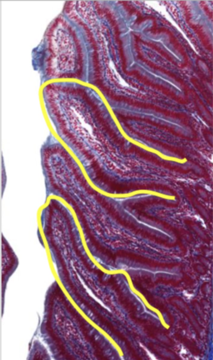 knowt flashcard image