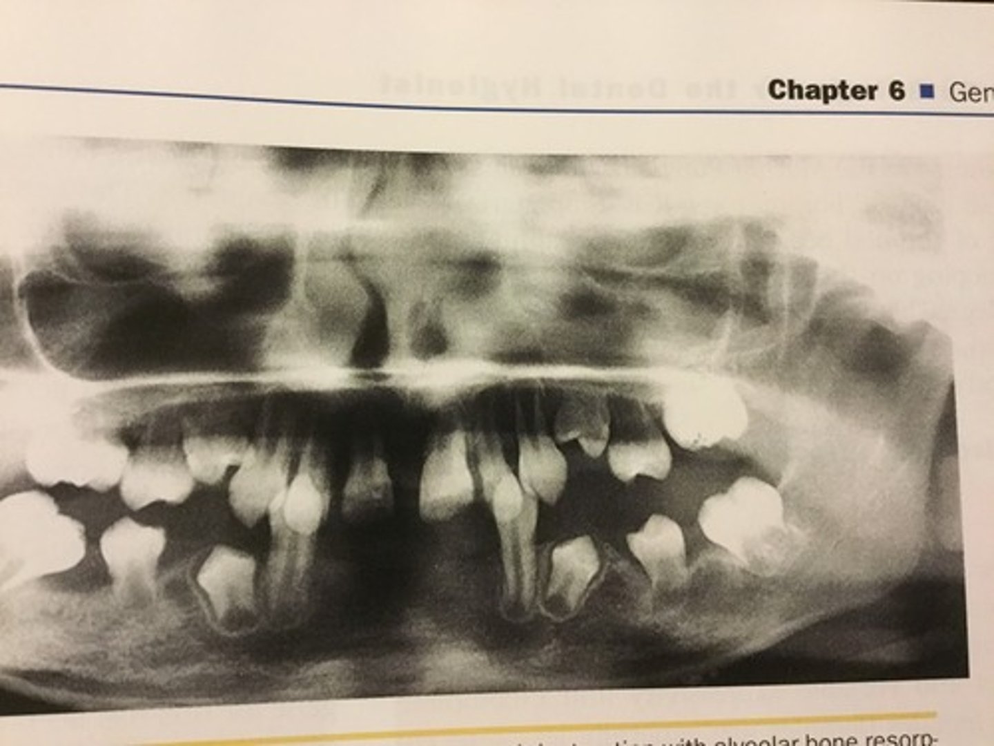 <p>1.5 - 2 years of age</p>