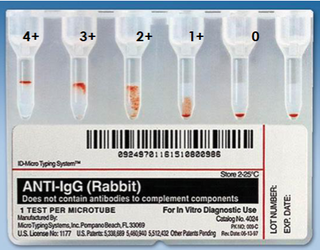 <ul><li><p>4+ = cells remain suspended at top of gel</p></li><li><p>3+ = most cells suspended at top of gel</p></li><li><p>2+ = cells dispersed throughout the gel; few agglutinates may be observed in bottom of gel</p></li><li><p>1+ = cells dispersed in lower portion of gel; unagglutinated cells form pellet in the bottom</p></li><li><p>negative (0) = complete sedimentation of all red cells at the bottom</p></li><li><p>mf = band of red cells at top of gel accompanied by a pellet of cells at the bottom</p></li></ul><p></p>