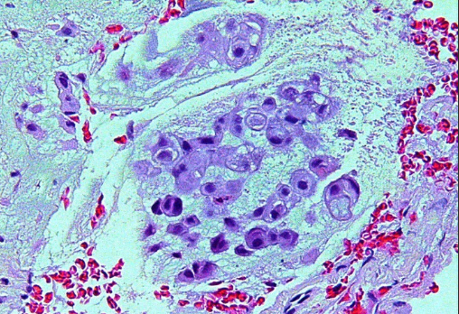 term image