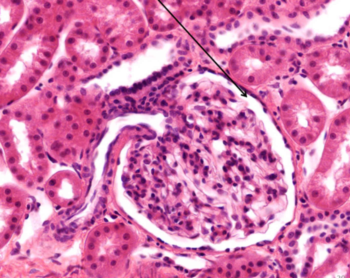 <p>The clear space around the glomerulus is the lumen of</p>
