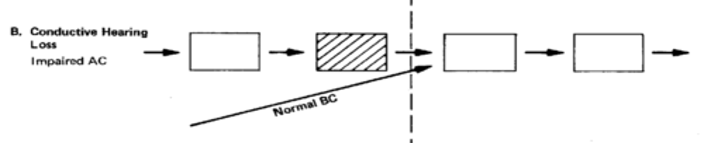 <p>- middle ear is affected (MEANING AC IS IMPAIRED).</p><p>- NORMAL BC.</p><p>- cause of possible lesion could be otitis media.</p>