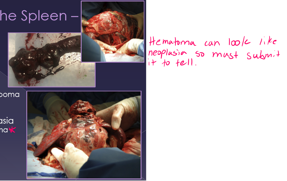 <ul><li><p>differentials </p><ul><li><p>non-neoplastic </p><ul><li><p>hematoma </p></li></ul></li></ul></li><li><p>benign neoplasia </p><ul><li><p>Lipoma / myelolipoma </p></li><li><p>hemangioma </p></li><li><p>fibroma </p></li></ul></li><li><p>malignant neoplasia </p><ul><li><p><strong>Hemangiosarcoma* - most common </strong></p></li><li><p>fibrosarcoma </p></li><li><p>liposarcoma </p></li><li><p>mast cell tumor </p></li></ul></li><li><p>treatment </p><ul><li><p>cardiovascular stabilization </p></li><li><p>electrocardiogram </p></li><li><p>± blood transfusion </p></li><li><p>splenectomy </p></li></ul></li></ul><p></p>
