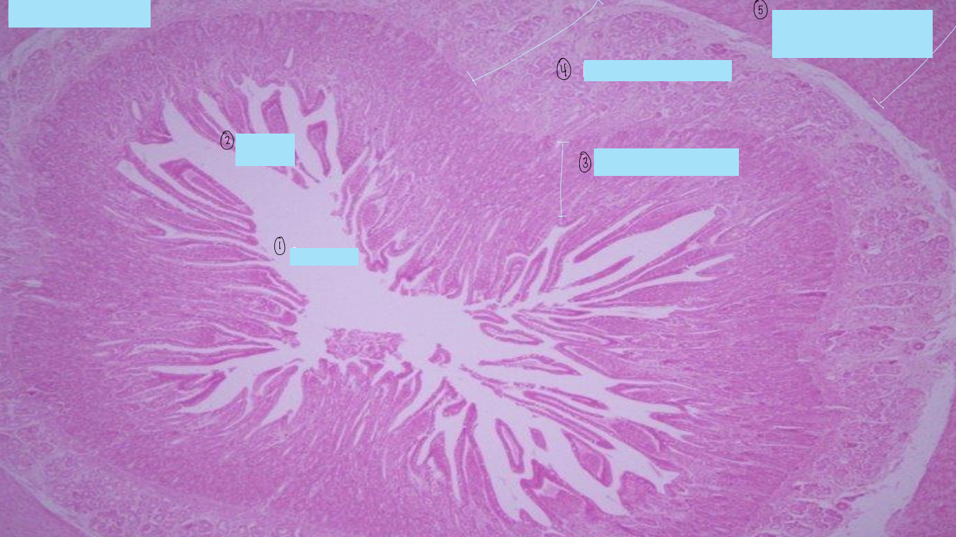 <p>what is this a histological slide of?</p>