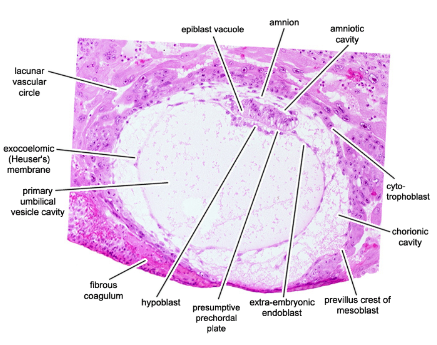 <p>Day 12 Embryo</p>