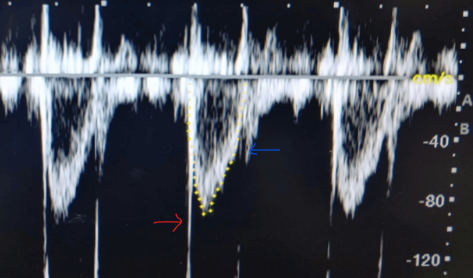 <p>Describe what the red and blue arrows are indicating.</p>