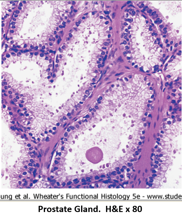 <p><strong>Pseudostratified epithelium</strong> of <strong>varying height</strong>, influenced by <strong>testosterone</strong> levels.</p>