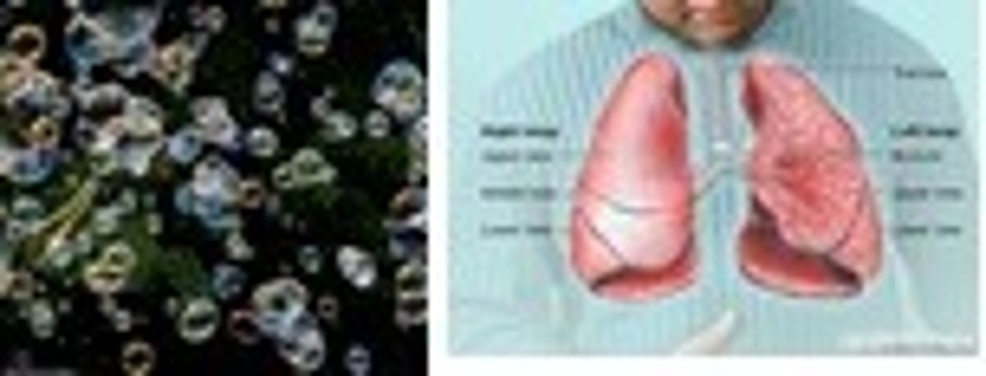 <p>(i) air, gas: (ii) lung</p>