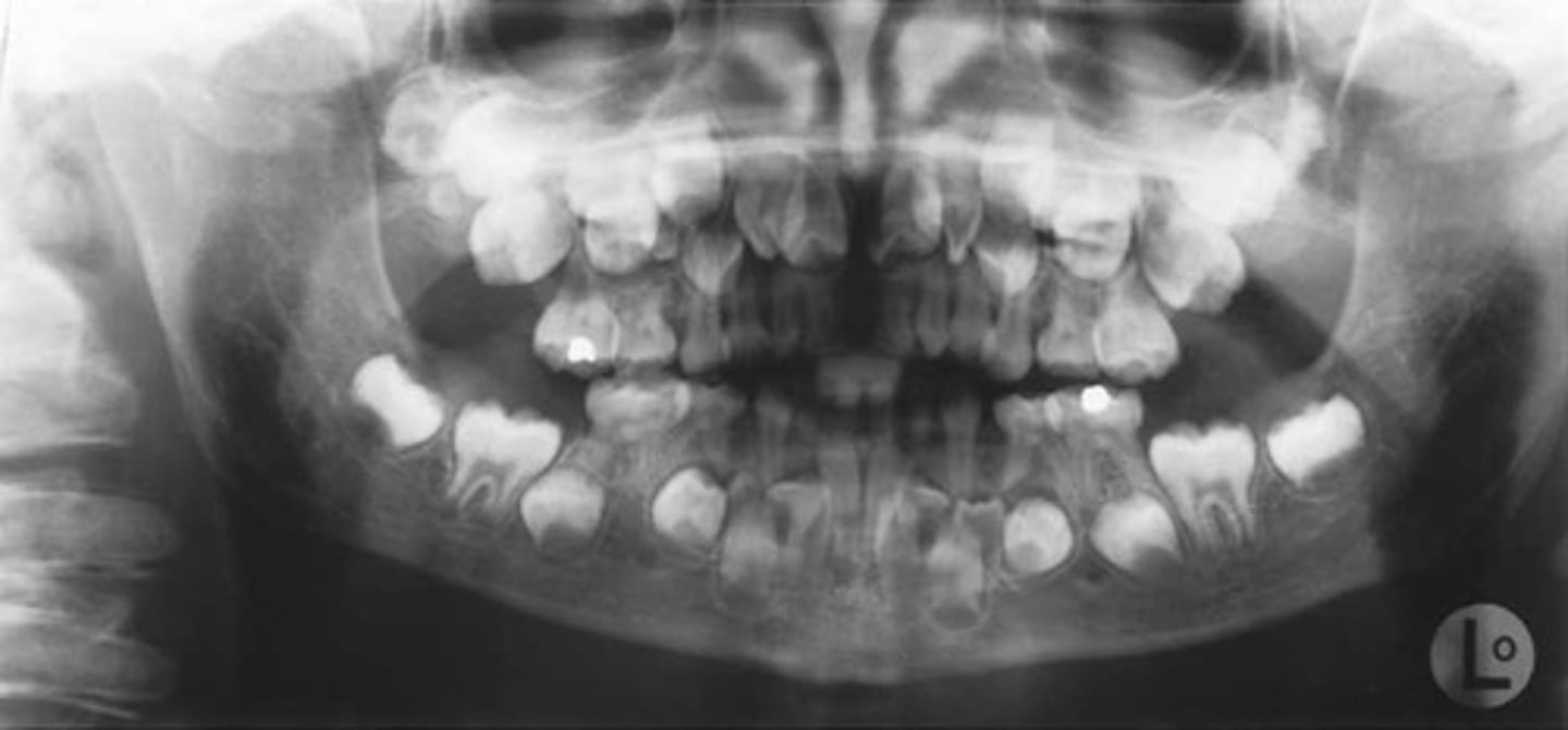 knowt flashcard image