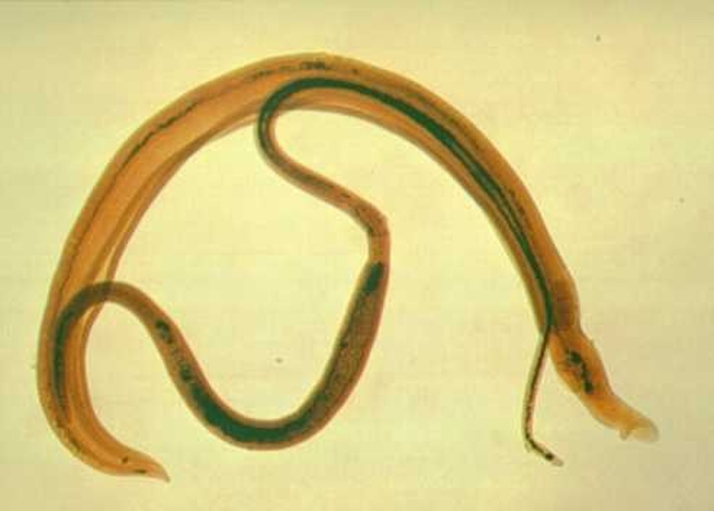 <p>schistosomes/blood flukes body plan</p>