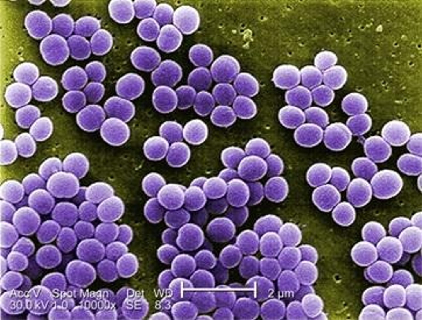 <p>Staphylococcus aureus.</p>