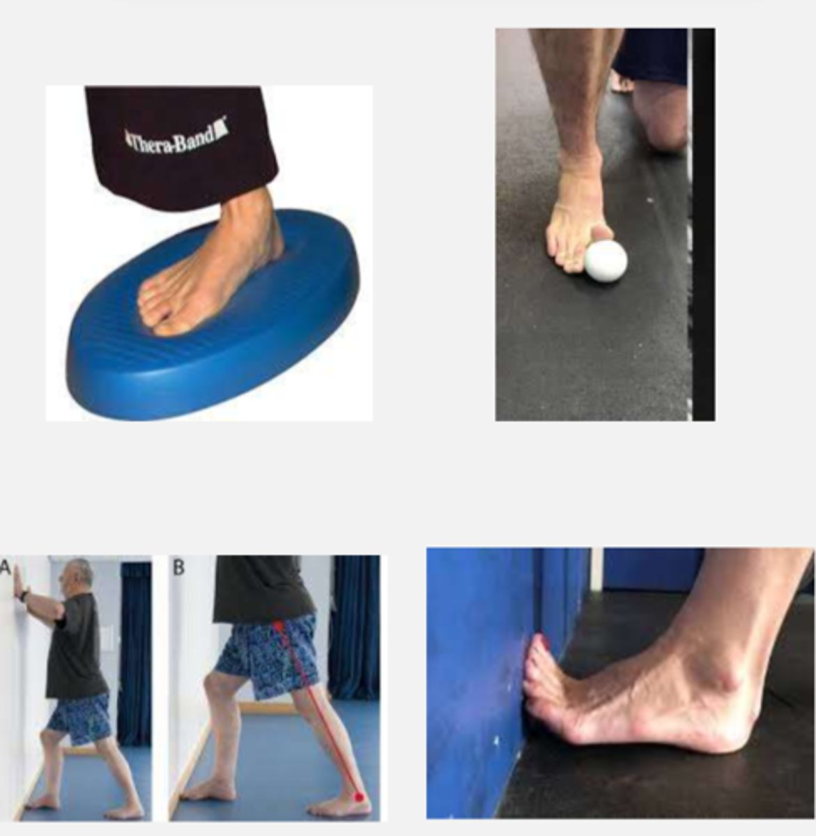 <p>- toe, foot, and ankle mobilization</p><p>- hallux/toe stretching into extension</p><p>- extensor strengthening exercises</p><p>- gastroc stretching</p><p>- DF strengthening exercise</p><p>- stretching and strengthening in any other areas of limited ROM and weakness</p><p>- static and dynamic balance, proprioception, ambulation on uneven surfaces</p><p>- assistive device training</p><p>- endurance/cardiorespiratory fitness</p>