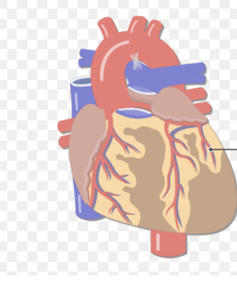 artery that branches off of top of anterior interventricular artery