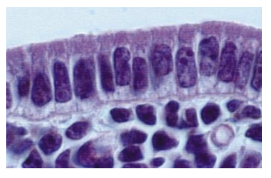 <p>Consists of a single layer of cells</p><p>Cells resemble a row of pillars</p><p>Each cell is tall and columnar-shaped</p>