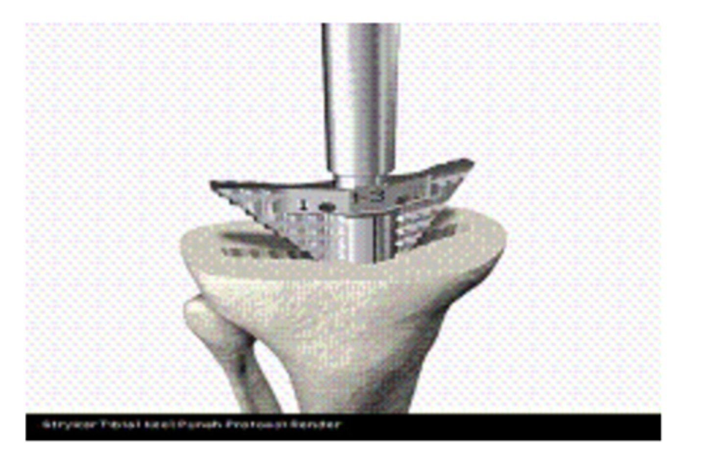 <p>This picture shows Keel punch.</p><p>(T/F)</p>