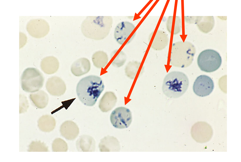 <p>What normoblastic maturation stage &amp; stain type is in the image?</p>