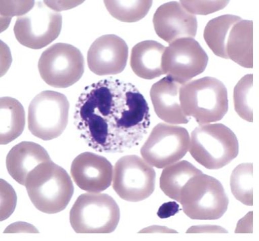 <p>which leukocyte is this?</p>