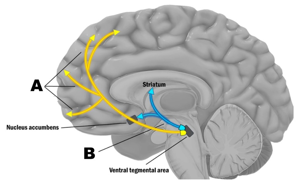 <p>According to the dopamine hypothesis of schizophrenia, pathway B in the figure above is</p><ul><li><p>hyperactive</p></li><li><p>hypoactive</p></li><li><p>missing</p></li><li><p>congenitally deformed</p></li></ul><p></p>