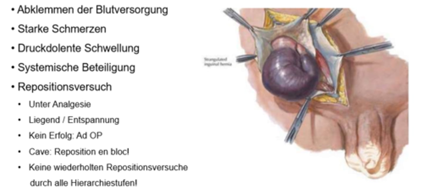 <p>Darmwanddruchbruch</p>