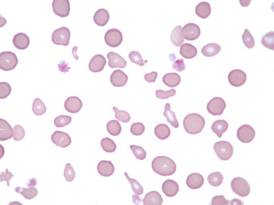 <p>spp wc has rbc marked by poikilocytosis (prominent in kids) and the smallest of the domestic animal spp</p><ul><li><p>do not display prominent reticulocytosis in response to anemia, lack polychromasia</p></li><li><p>life span: 125 days</p></li></ul><p></p>