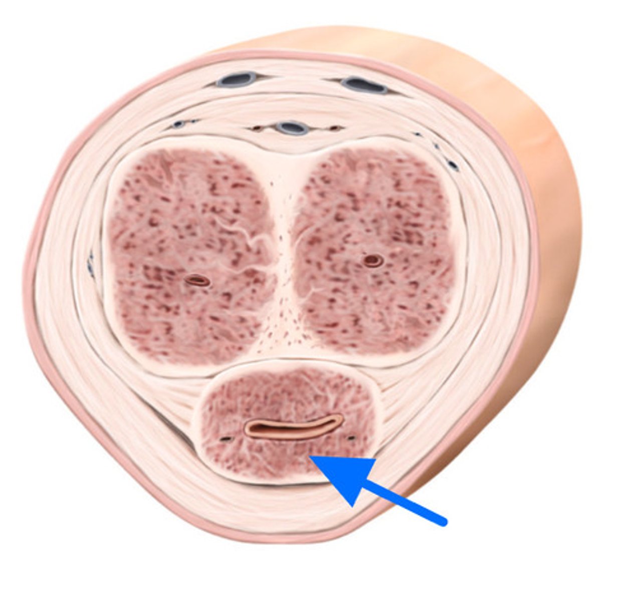 <p>ID Structure Marked with the Blue Arrow</p>