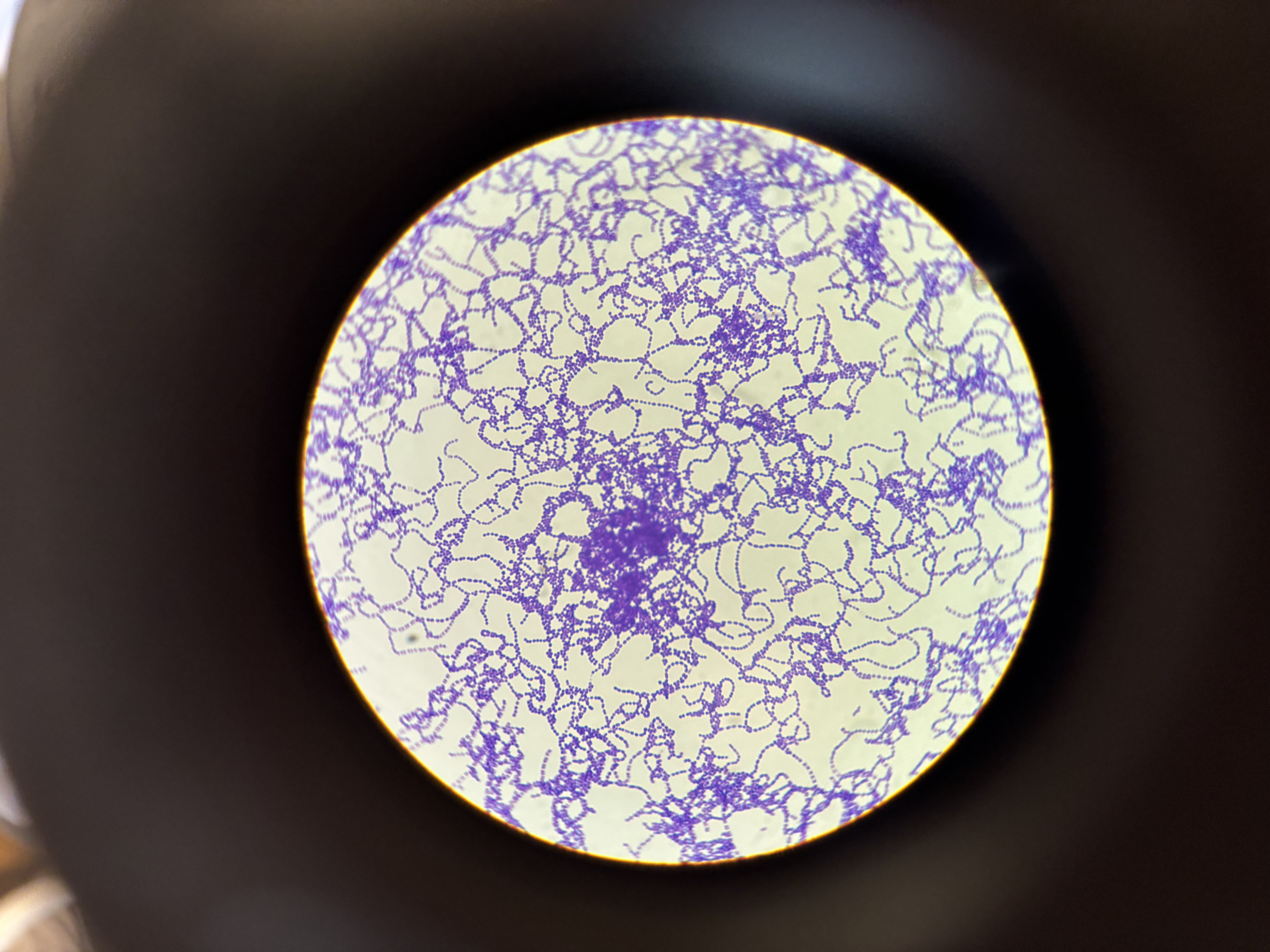 <p>S. pyogenes</p>