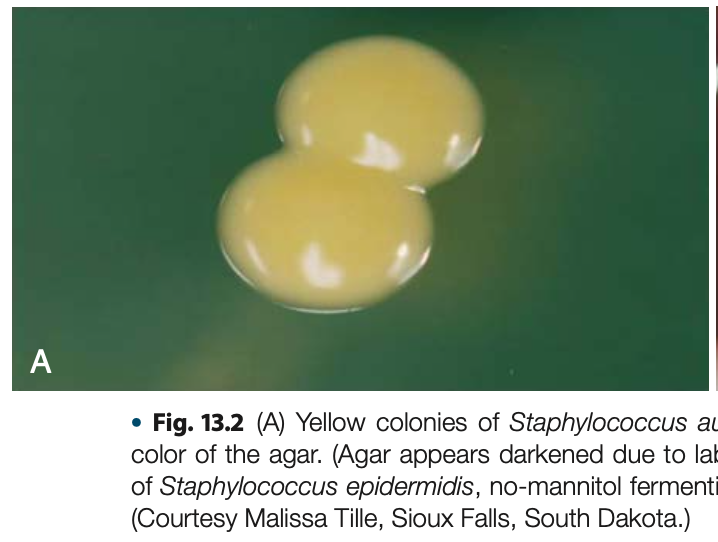 <p><mark data-color="yellow" style="background-color: yellow; color: inherit">yellow colonies </mark></p>