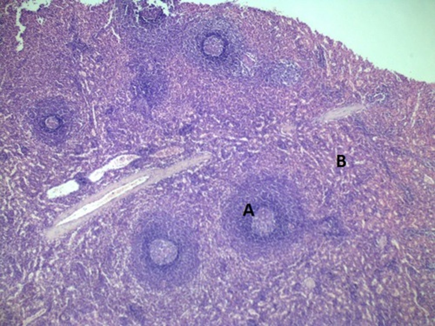 <p>The area labeled B contains a high concentration of what cells?</p>
