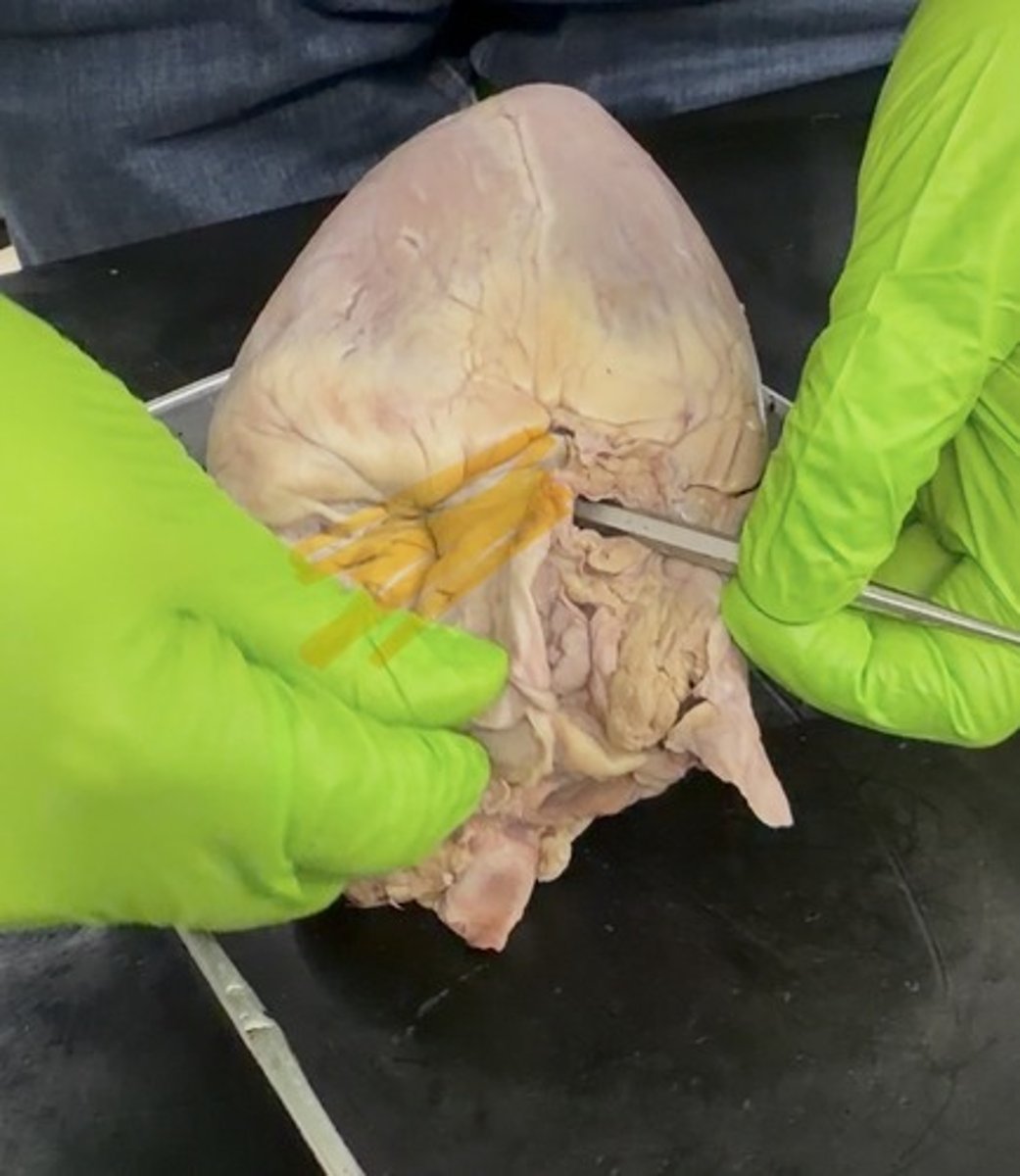 <p>where prob is in</p>