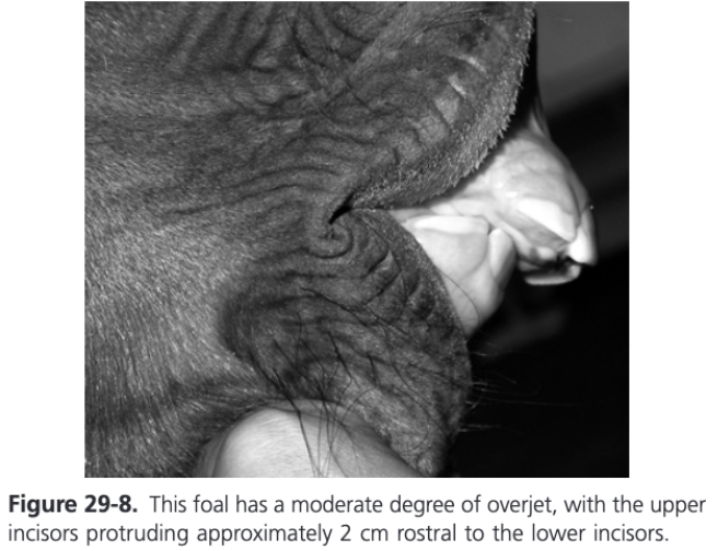<p><span>R</span>ostral projection of the upper incisors beyond the lower incisors in a horizontal plane</p>