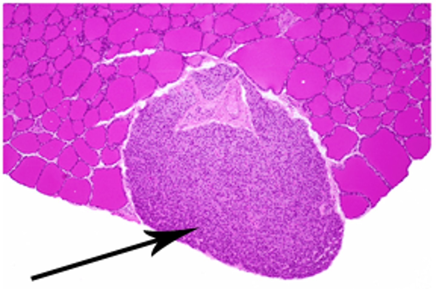 <p>what organ does this slide show</p>