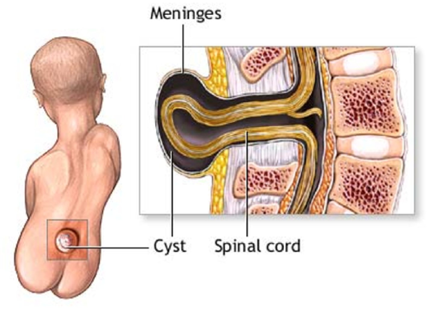 <p>abnormality present at birth</p>