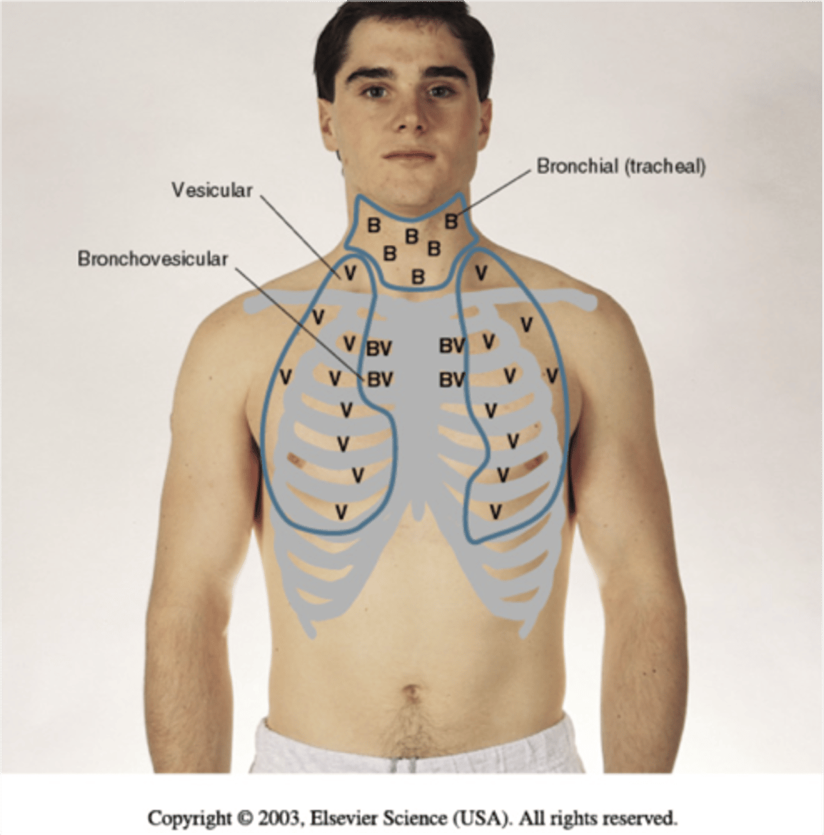 <p>location: heard over trachea and larynx</p><p>pitch: high</p><p>amplitude: loud</p><p>duration: heard during expiration</p><p>quality: harsh, hollow, or tubular</p>