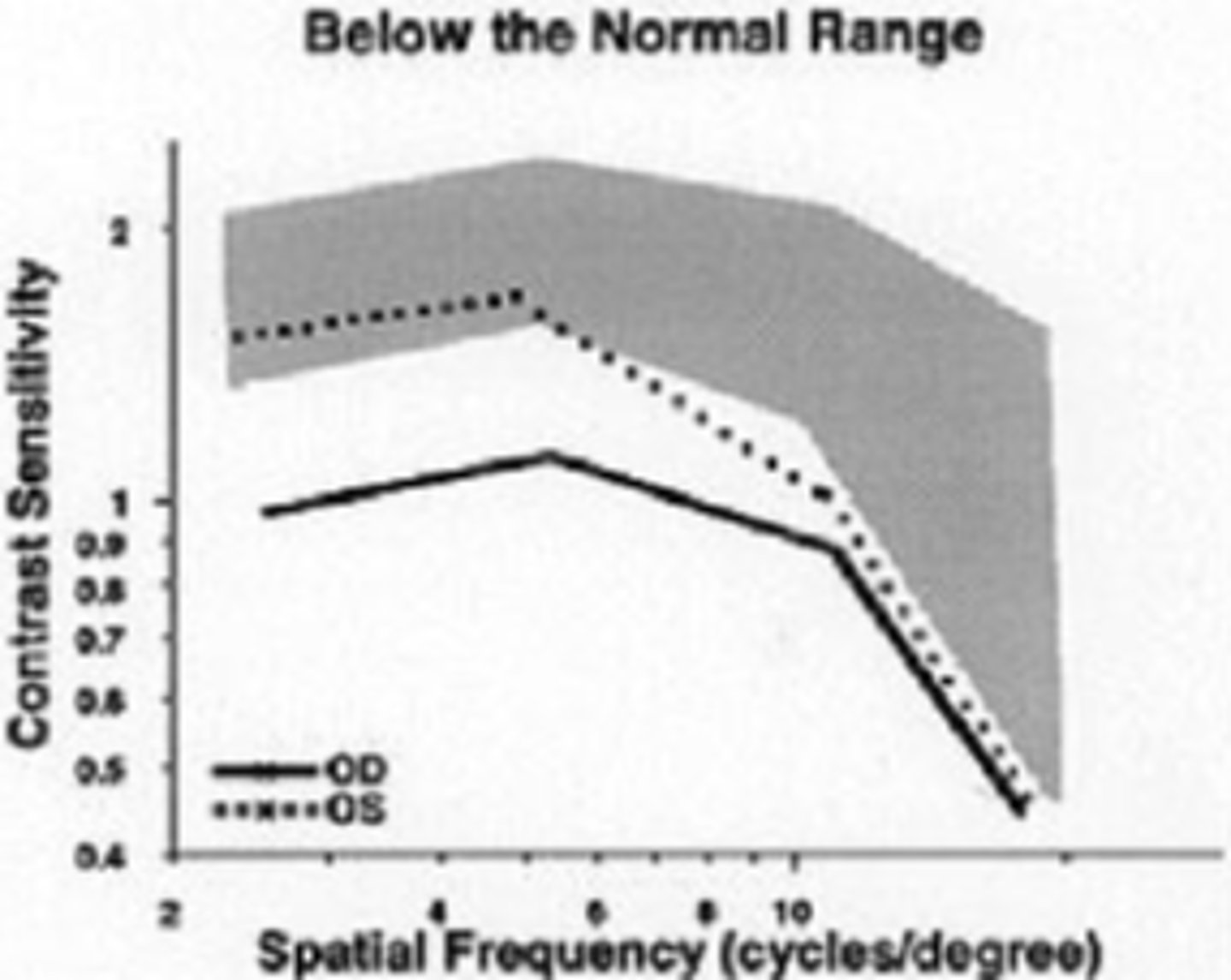 <p>loss at SF other than 20/20 equivalent </p><p>can check CS for 1 point on the curve: at 5 cpd (20/100 Snellen letter; peak of CSF function), reduce contrast until last detected letter</p>