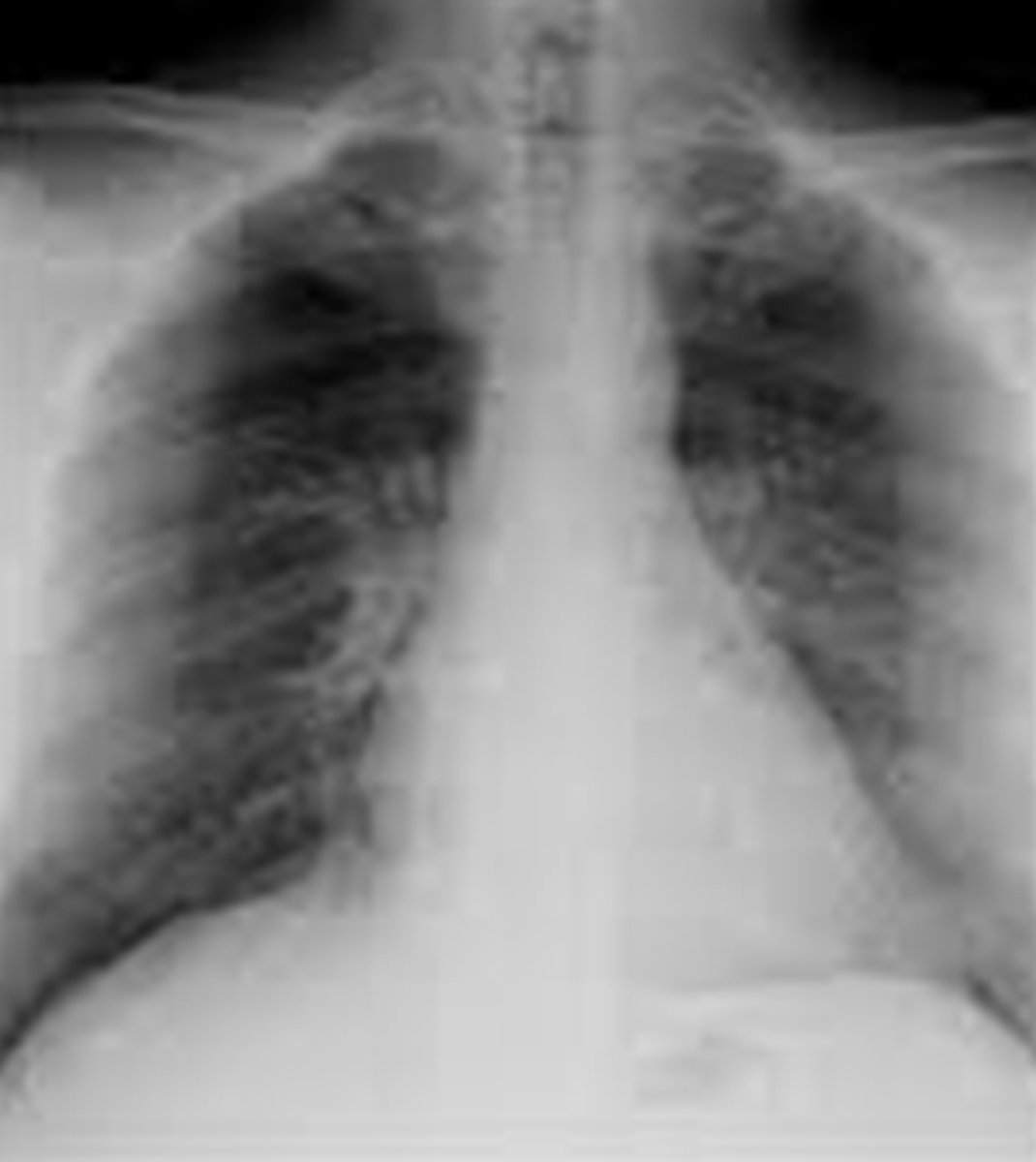 <p>Which view is this?</p>