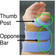 <p>What is this? How is it placed? What materials are used to make the orthosis? Indications for use?</p>