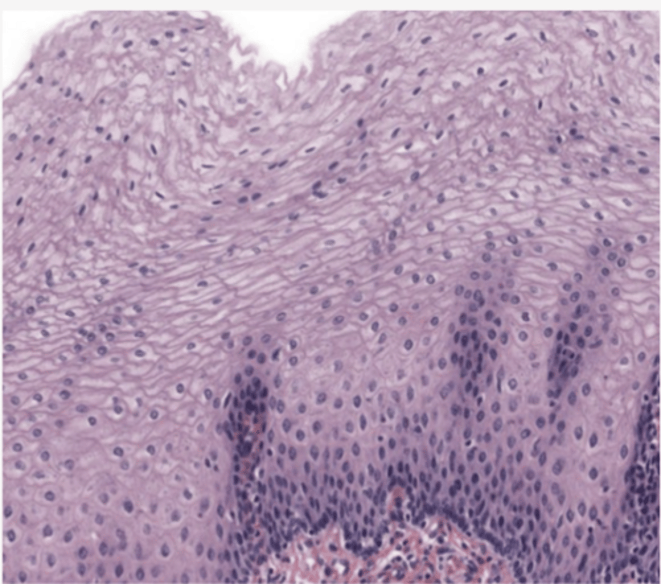 <p>Identify the type of epithelia</p>