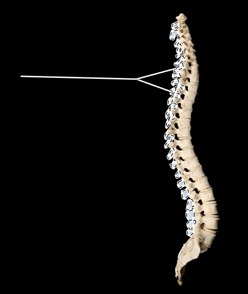 <p>What part of the vertebra is highlighted?</p><p>What is the proper name for this entire bone structure?</p><p>(Lateral view).</p>