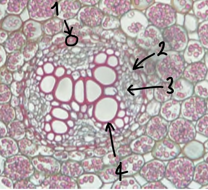 <p>(zoomed in area inside the endodermis) name the structure in label 4</p>