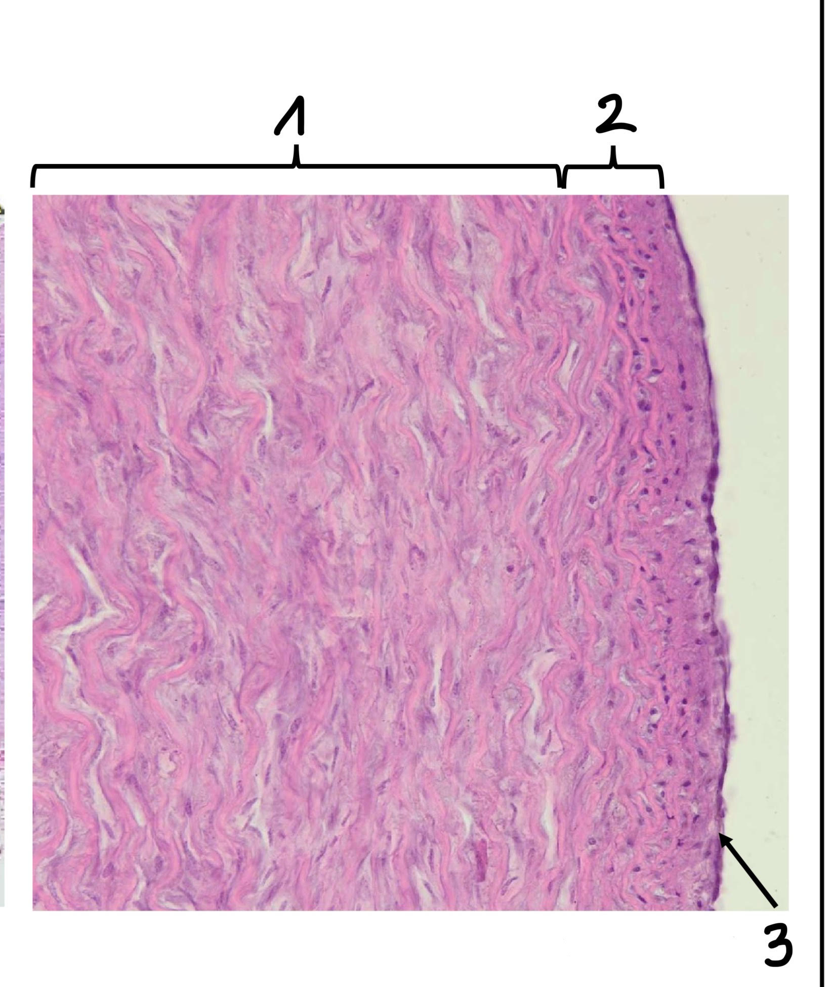 term image