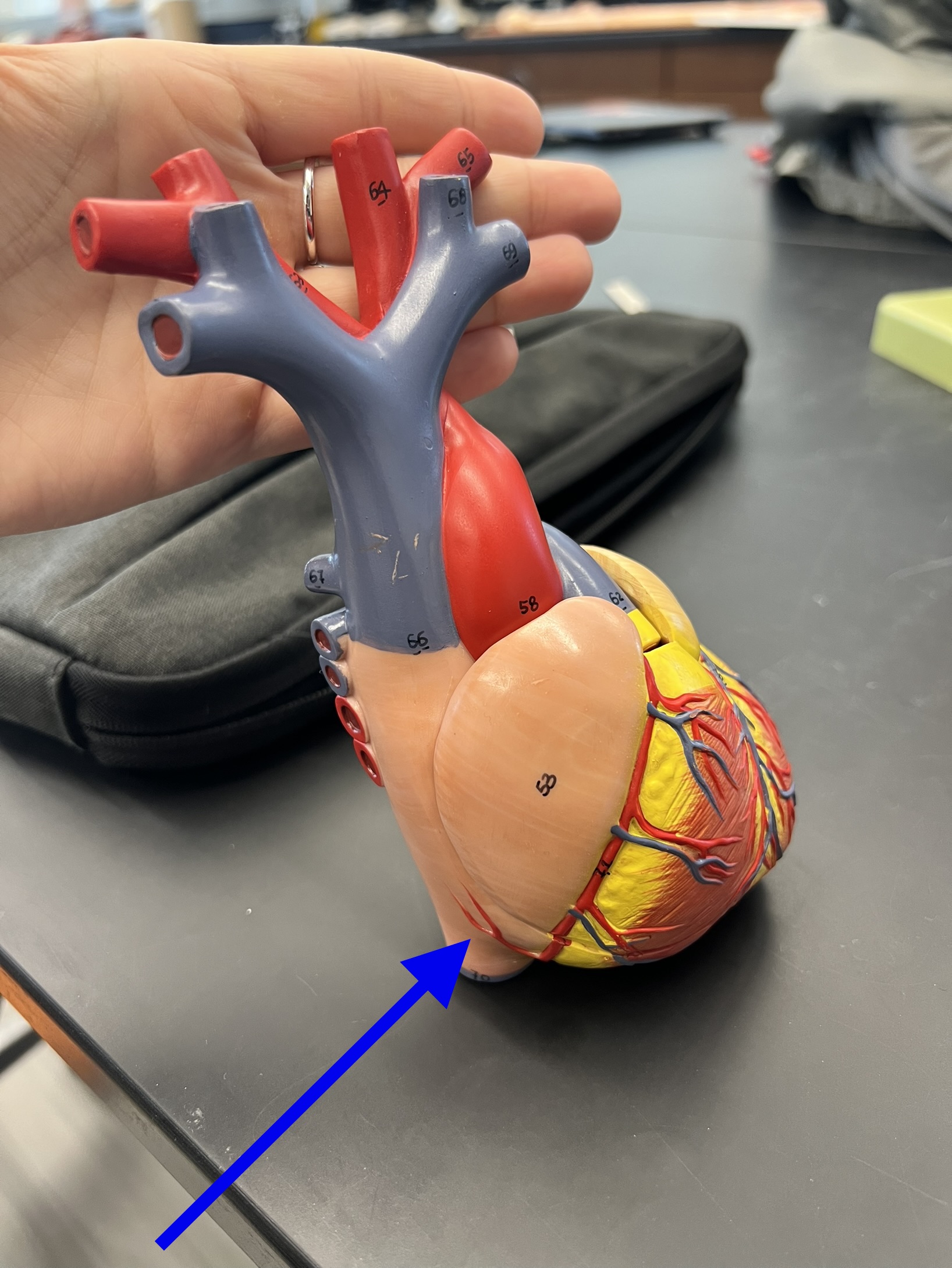 Name the heart structure.